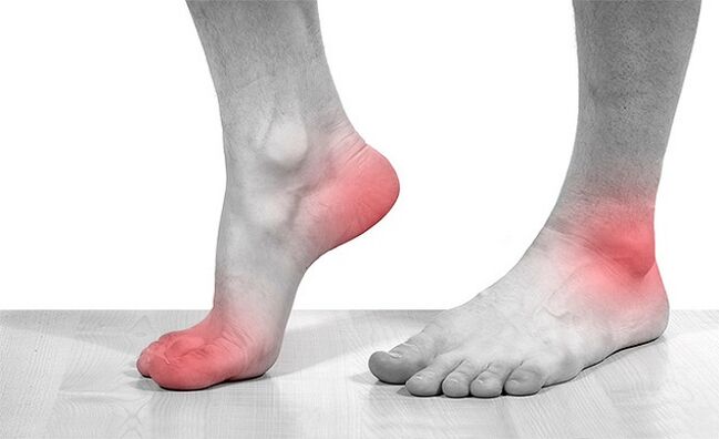 आर्थ्रोसिस के साथ टखने के जोड़ों में दर्द