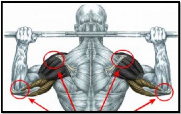 कंधे और कोहनी की मांसपेशियों पर भार कंधे के जोड़ के आर्थ्रोसिस के कारणों में से एक है